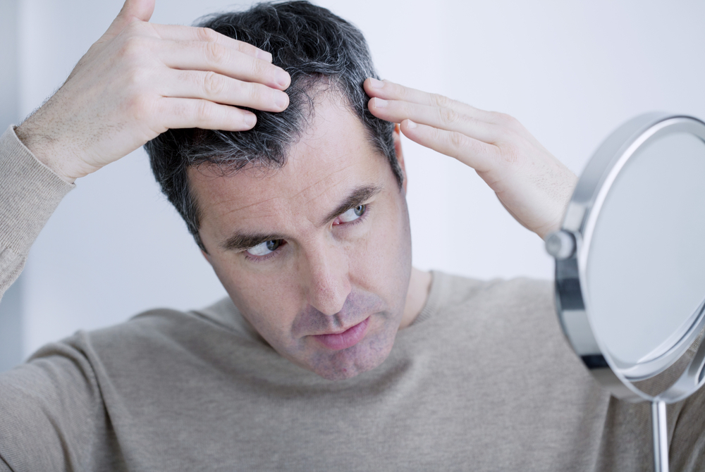 Drinking Soda Regularly Found To Cause Hair Loss In Men - Urban Care Clinic