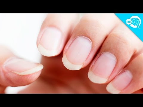 Manicure May Have Given Woman Cancer: ‘It Hurt A Lot’